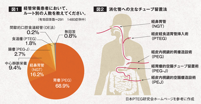 経 チューブ 管 栄養 鼻 経 経鼻経管栄養 100人中100人が抜いてくれと訴える苦しさ｜NEWSポストセブン