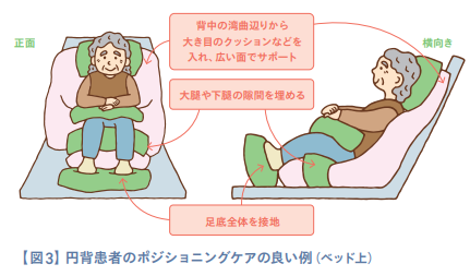 【図3】円背患者のポジショニングケアの良い例（ベッド上）
